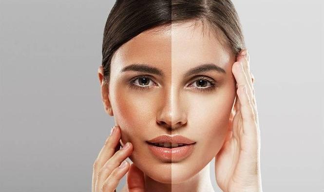 دیگر حسرت نداشتن جلد سفید و صاف را نداشته باشید 0781284744