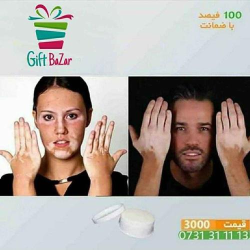 مرهم ترکیبی مخصوص لكه سفید