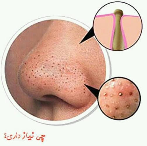 مکنده چارچی. ، ، ،،،،،