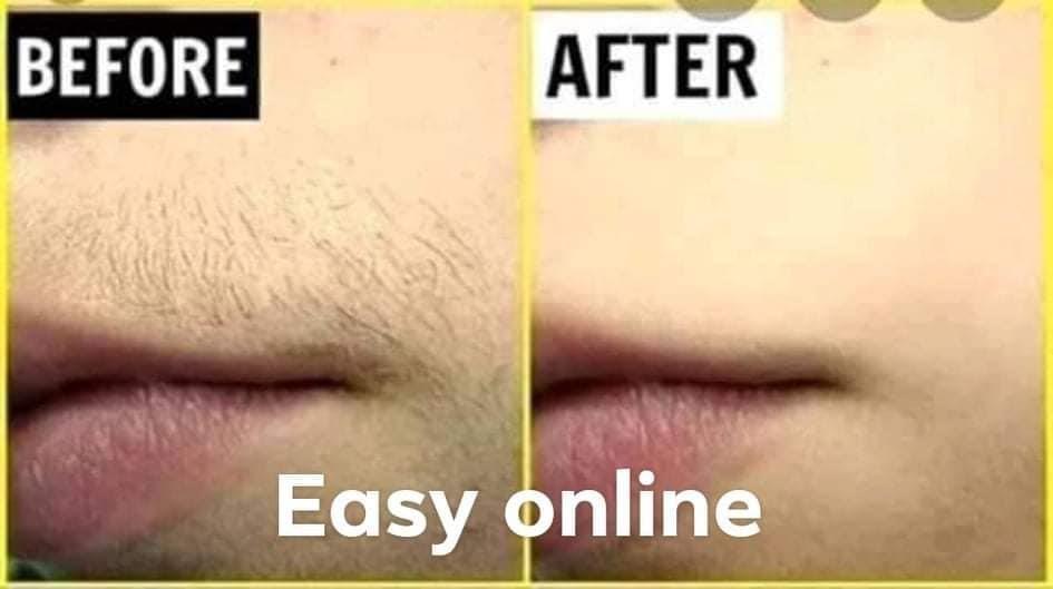 سمارت-مینی---0785220333----0702855252