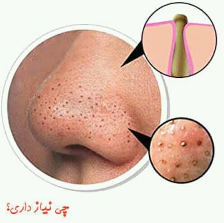 مکنده-چارچی-----------