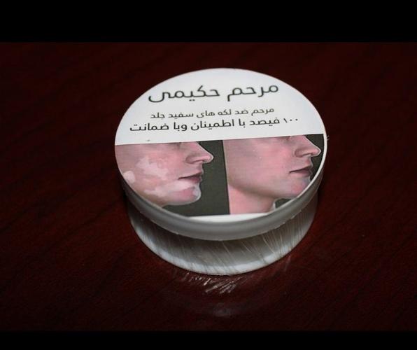 مرهم ترکیبی مخصوص لکه پیس با ضمانت