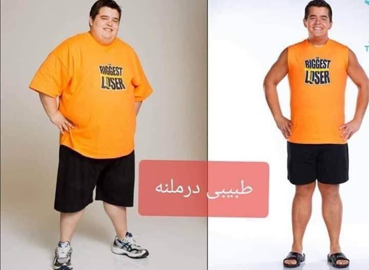 ایا-از-چاقی-رنج-میبرین