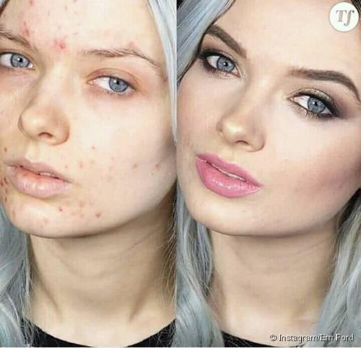 مکنده چارچی،،،،،، ،،،،، ،،،،