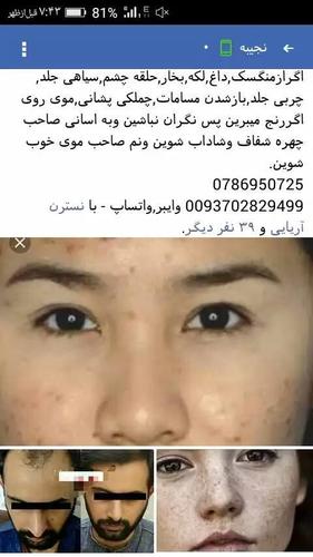 دوای سفافیت روی وتقویه موی مردانه وزنانه