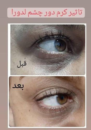 کریم دور چشم لدورا رایحه کشور فرانسه با ضمانت