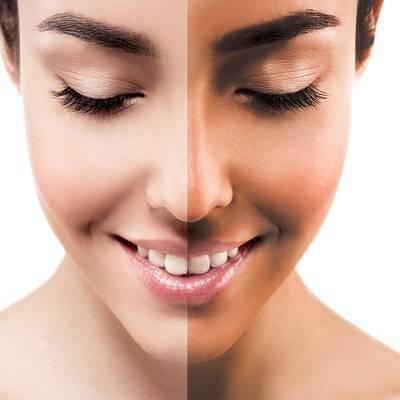 بهترین کریم ضمانتی برای سفیدی و از بین بردن لکه های سیاه و ل