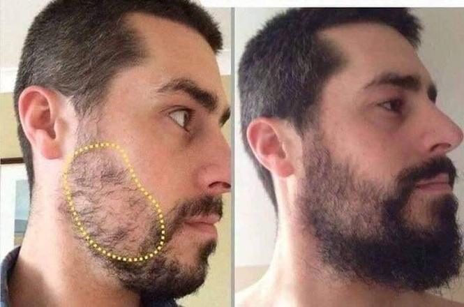 بهترین محصول رشد ریش آقایان