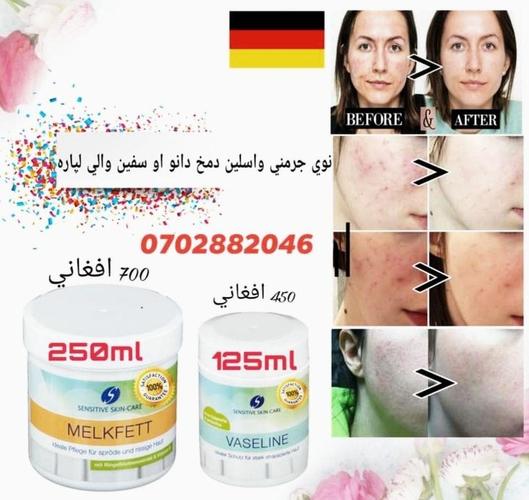 جرمني د مخ سپينولو او دسرو دانو ختمولو واسلین