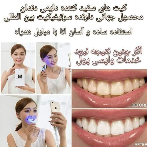 برای قیمت و معلومات لطف نموده مسج کنید...