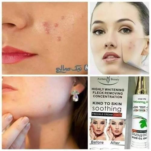 کریم ضد بخار و ضد لکه Aichun Beauty