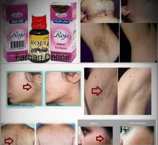 مژدهمژدهمژده.... به كساينكه علاقمند روغن مورچهدر شهر