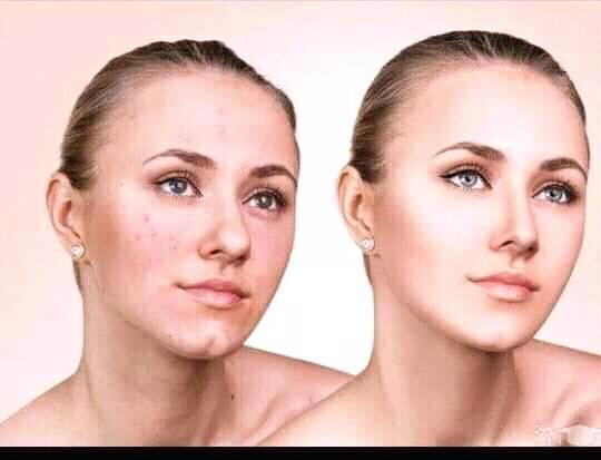 پکیچ-سفید-کننده