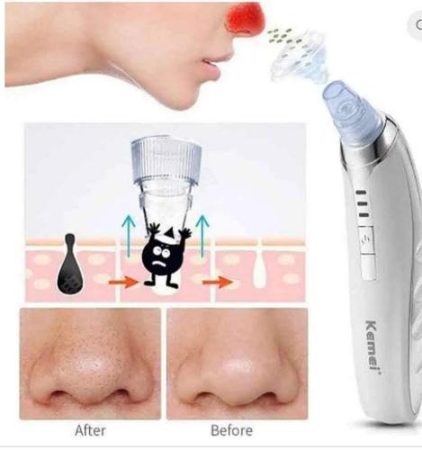 ماشین ساکشن برای پاکسازی صورت از بخار و چربی