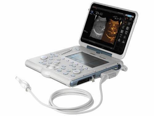 ESAOTE MYLAB ALPHA PORTABLE ULTRASOUND