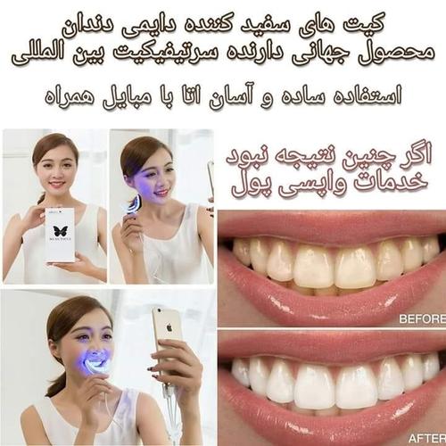 سفیدی دندان ها با مبایل همراه شما