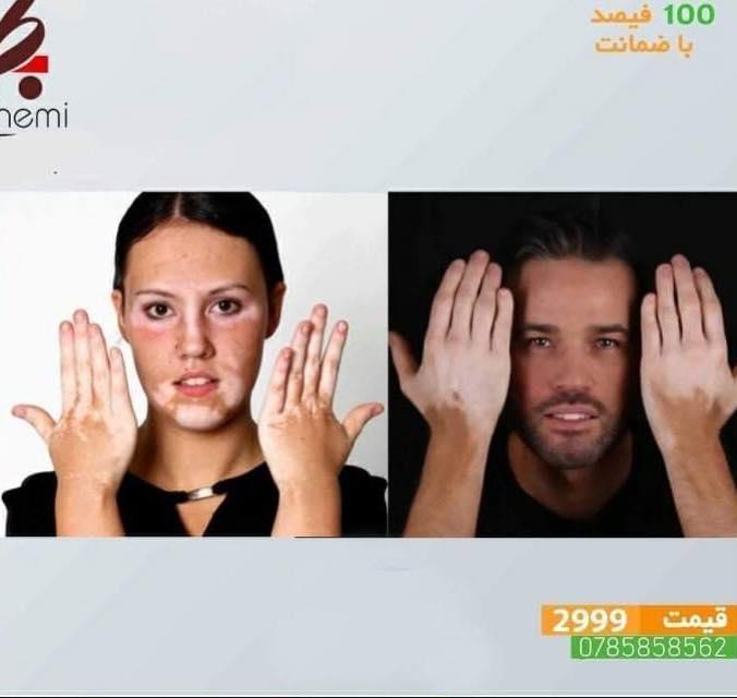مرحم-ترکیبی