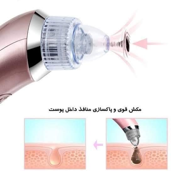 دستگاه-مکنده