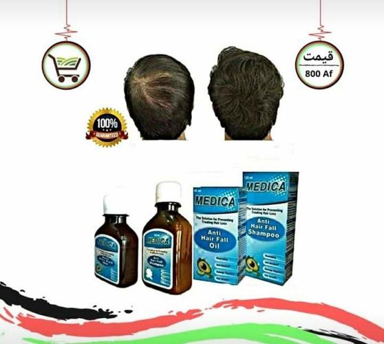 د وريښتيانو ټينګولو لپاره بهترين شامپو او روغن