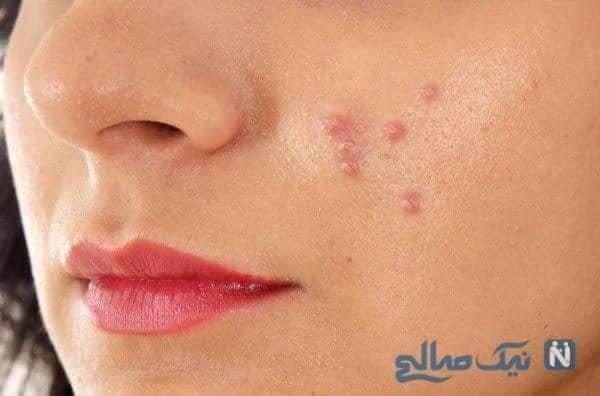 دستگاه-مکنده