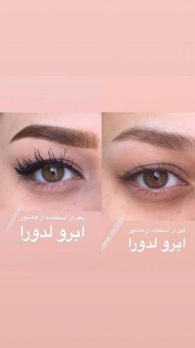 تونیک_تقویت_کننده_ابرو