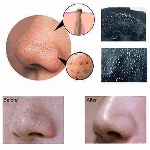 ماسک سیا یا BLACK MASK یک محصول فوفالعاده،