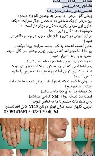 آدرس : گلبهار سنتر منزل تهکو دوکان نمبر A143 کابل افغانستان.