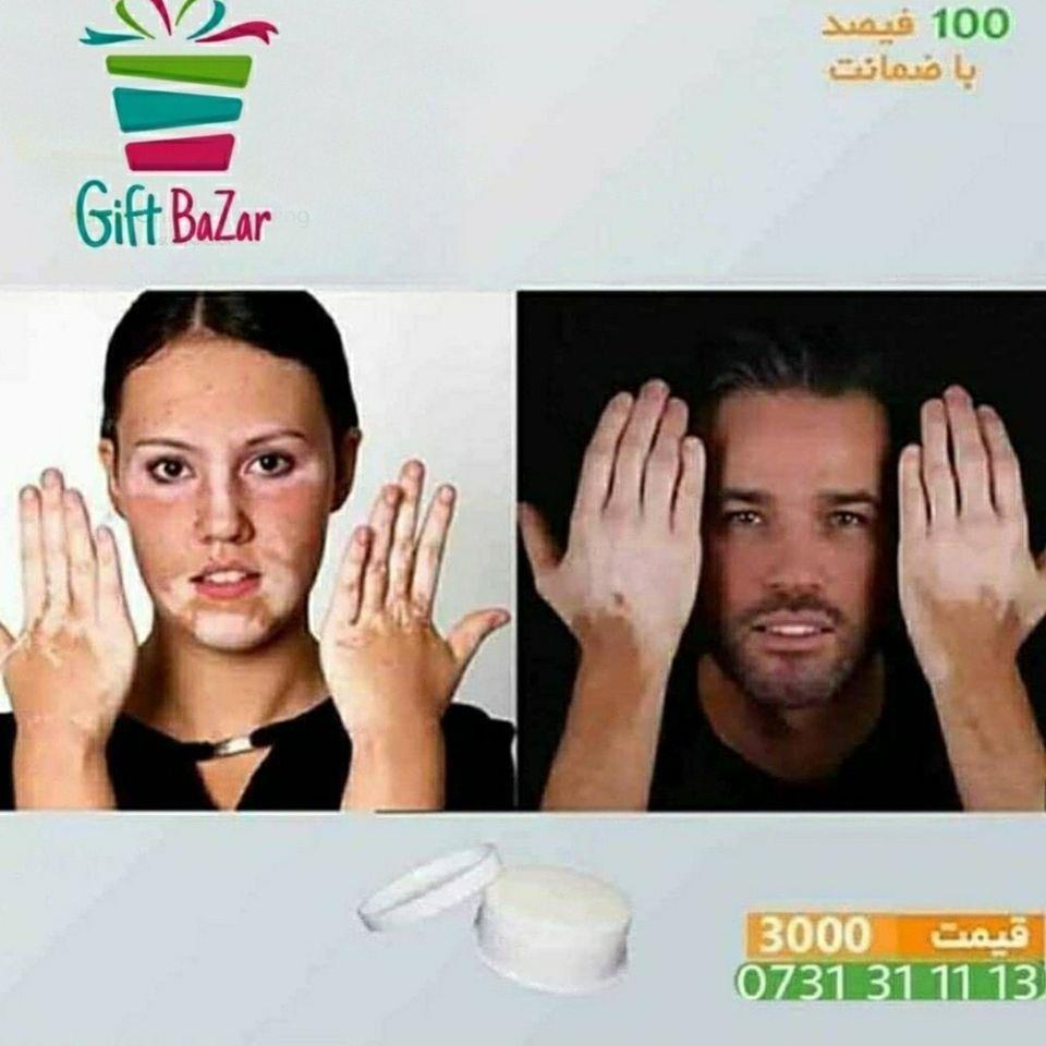 مرهم-ترکیبی-برای-پیس