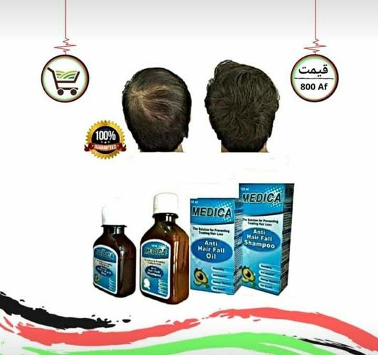 د وريښتيانو ټينګولو لپاره بهترين شامپو او روغن