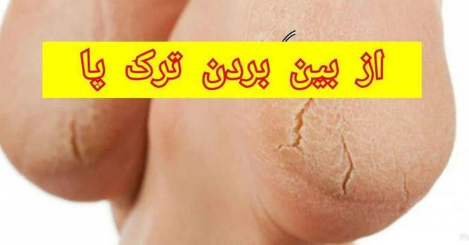 پاپوش سلیکانی