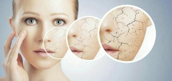 بیشتر_بدانید پوست_خشک