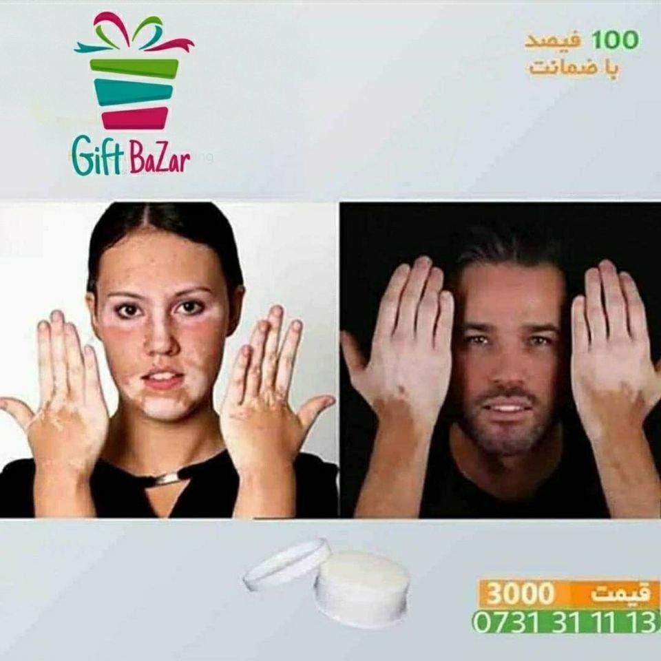تداوی-لکه-سفید