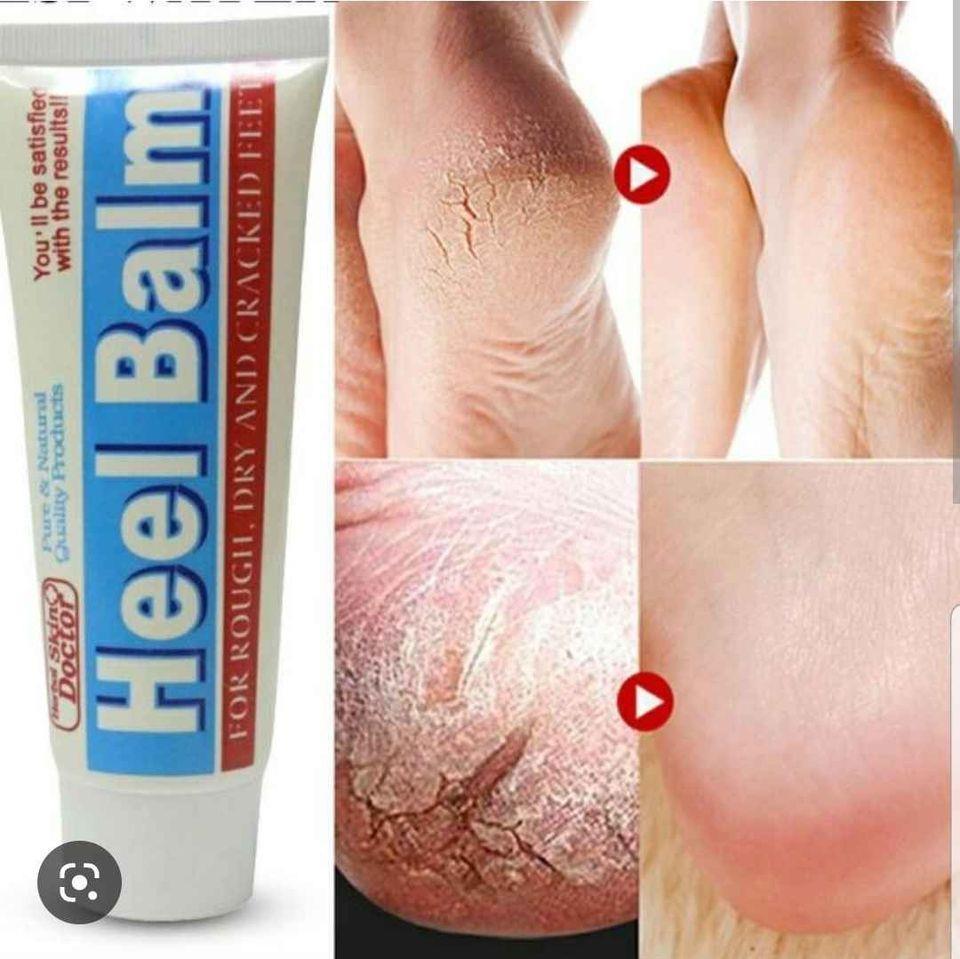کریم-ترکیده-گی-پای-Heel-Balm
